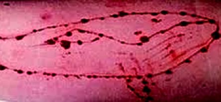 Mammiferi a rischio: Blue Whale